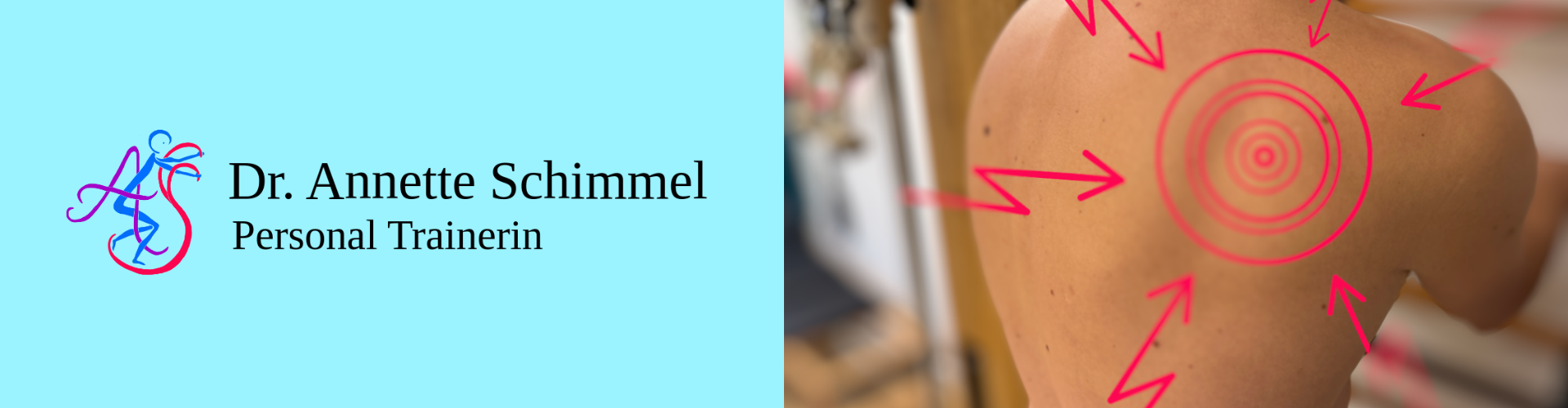 rückenschmerzen personal training